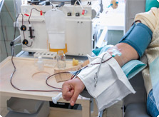 Plazmaferez1 Plazmaferez1